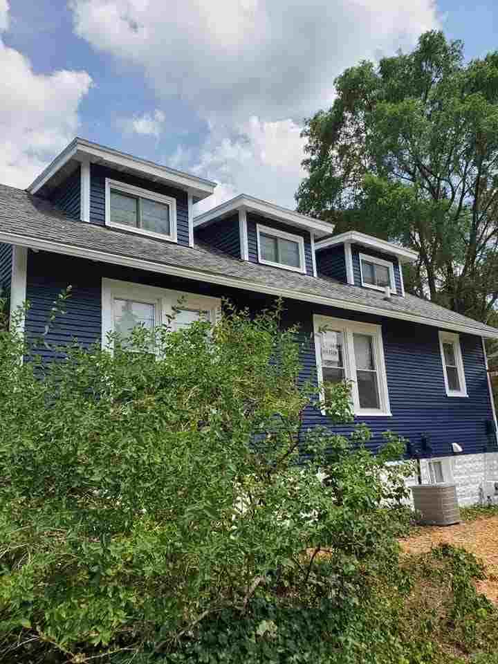 Blue Anterior Before & After After